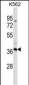 CLEC7A Antibody (N-term)